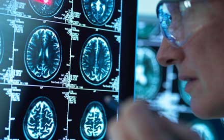 A neurologic physical therapist looks at a person's brain scans.