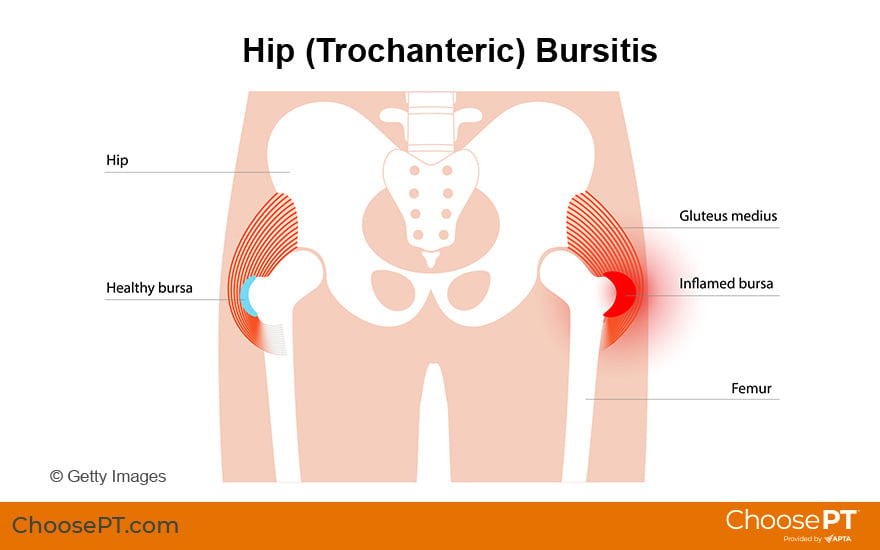 Guide to Hip Pain Relief and Treatment Options - Orthopedic