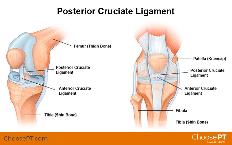 Posterior Cruciate Ligament (PCL) Injury: Symptoms & Treatment